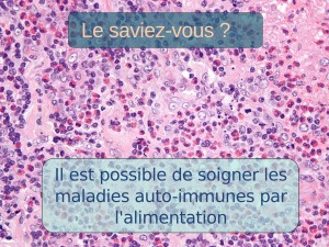 Le protocole auto-immune pour maîtriser sa maladie auto-immune