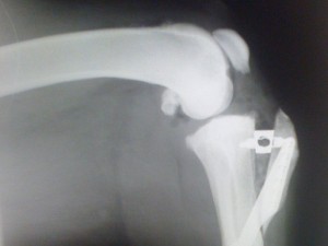 Soulager les douleurs aux articulations avec les packs chaud froid